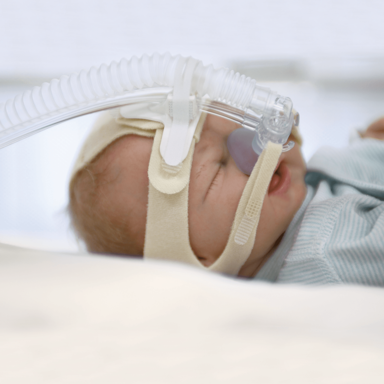 Achat d’un appareil de ventilation en pression positive continue pour nouveau-nés